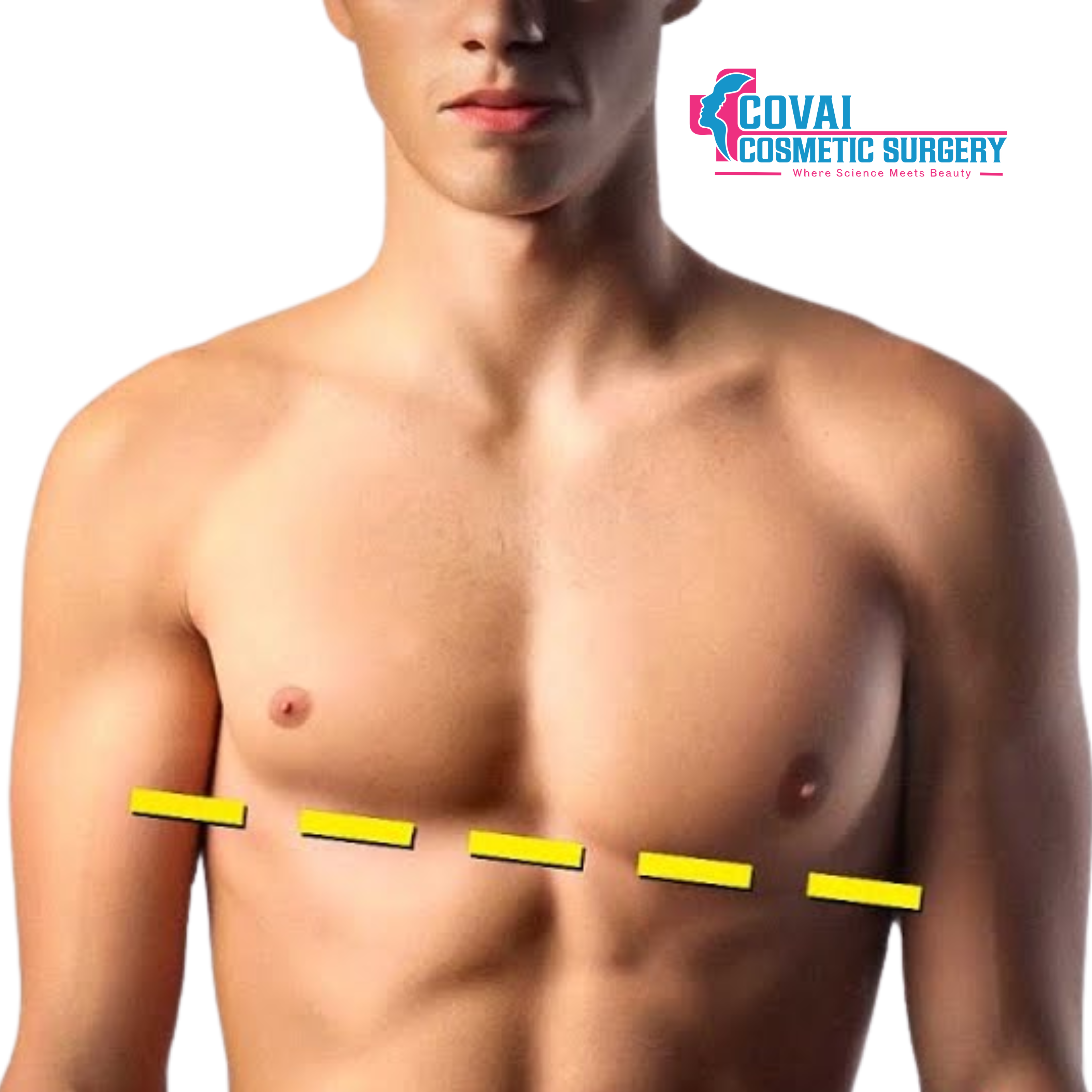 Asymmetrical Chest